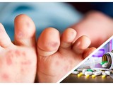 Có thông tin cho rằng thiếu thuốc điều trị bệnh tay chân miệng đang vào mùa cao điểm ở TP.HCM (Ảnh CarePlus, Hòa Bình ghép)