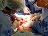Gần 100 bác sĩ tham gia ca đại phẫu tách rời hai bé Trúc Nhi - Diệu Nhi (Ảnh: BVCC)