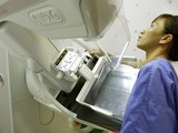 Bệnh nhân chụp Xquang vú tại Bệnh viện Bạch Mai