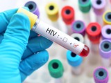 Nghiên cứu mới làm dấy lên hy vọng về một liệu pháp loại bỏ hoàn toàn virus HIV khỏi cơ thể người (Ảnh: Getty)
