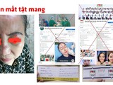 Trang facebook mạo danh Bệnh viện Trung ương Quân đội 108 khiến người dân "tiền mất, tật mang" (Ảnh - BVCC)