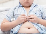 Ngày càng nhiều trẻ bị béo phì vì chế độ dinh dưỡng không hợp lý (Ảnh minh hoạ)