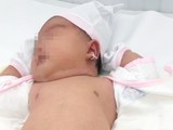 Bé gái chào đời nặng 5.2kg tại Bệnh viện Quận 11
