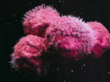 Tế bào ung thư ác tính. Ảnh minh họa EureKalert