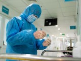 Trung tâm Y tế Vietsovpetro và Trung tâm Kiểm soát Dịch bệnh tỉnh Bà Rịa - Vũng Tàu đã lấy mẫu bệnh phẩm gửi Bệnh viện Thống Nhất, TP.HCM (Ảnh: BYT)