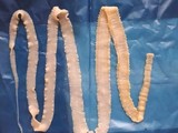 Mẫu sán dây của Viện sốt rét - Ký sinh trùng - Côn trùng TP Hồ Chí Minh