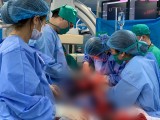 Các bác sĩ phẫu thuật cho sản phụ 42 tuổi bị rau tiền đạo, rau cài răng lược phức tạp (Ảnh: Bệnh viện Sản Nhi Quảng Ninh)
