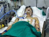 Bệnh nhân được điều trị tại Bệnh viện Hữu nghị Việt Đức với nhiều vết thương phức tạp (Ảnh: BVCC)
