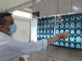 Bác sĩ xem phim chụp cộng hưởng từ sọ não của bệnh nhân bị nhiễm độc thiếc (Ảnh: Bệnh viện Bạch Mai)