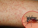Muỗi vằn, tác nhân lây truyền bệnh sốt xuất huyết
