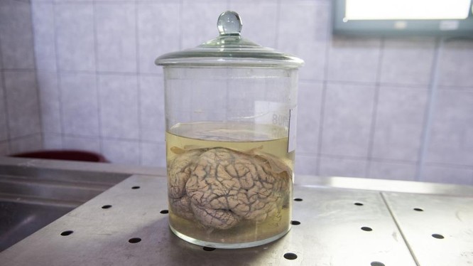 Một bộ não người được ngâm trong chất Formaldehyde, trưng bày tại Bảo tàng Neuropathology ở Lima, Peru (ảnh: Newsweek)
