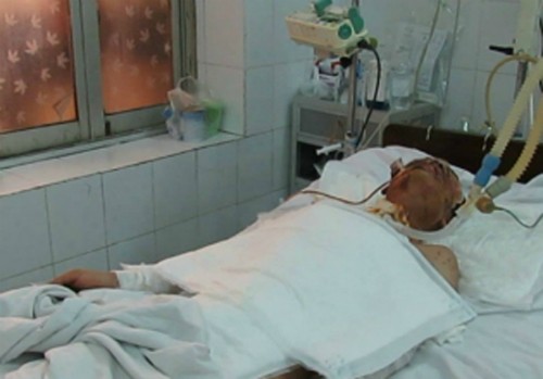 Bệnh nhân Đặng Cao Thủy khi điều trị tại viện. Ảnh: Lê Nga.
