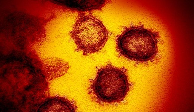 Hình ảnh qua kính hiển vi điện tử cho thấy virus corona chủng mới xuất hiện trên bề mặt tế bào người (Ảnh: Live Science)