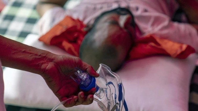 Thiếu giường bệnh và nguồn cung oxy khiến tình hình dịch COVID-19 ở Ấn Độ hết sức nghiêm trọng (Ảnh: Bloomberg)