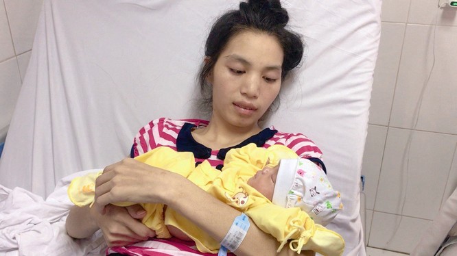 Chị Lù Thị Trình hạnh phúc bên bé gái mới chào đời. Ảnh: Bệnh viện Hữu nghị Việt Đức 