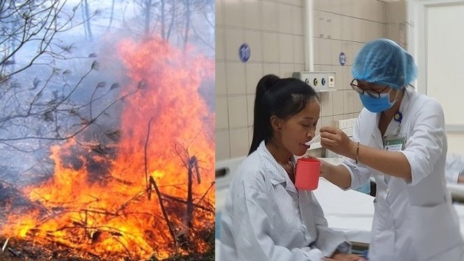 Bệnh nhân nhập viện trong tình trạng sốc nhiệt vì đốt nương làm rẫy. Ảnh: Bệnh viện Bạch Mai