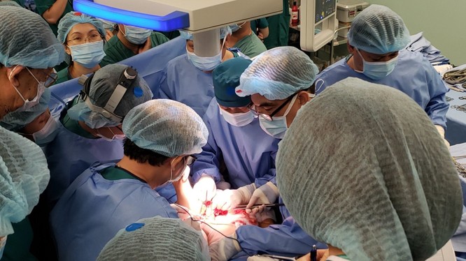 Bác sĩ tiến hành phẫu thuật tách rời cặp song sinh (Ảnh: Bệnh viện Nhi đồng Thành phố) 