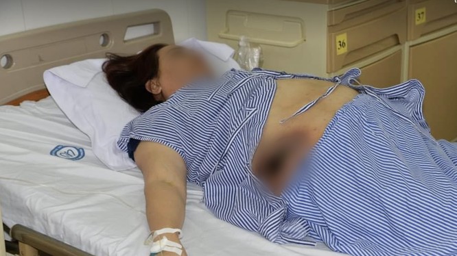 Bệnh nhân đái tháo đường bị loét bụng sau khi bôi thuốc của thầy lang (Ảnh: BVCC) 
