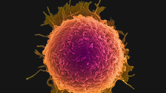Đĩa nano có thể diệt các tế bào ung thư?