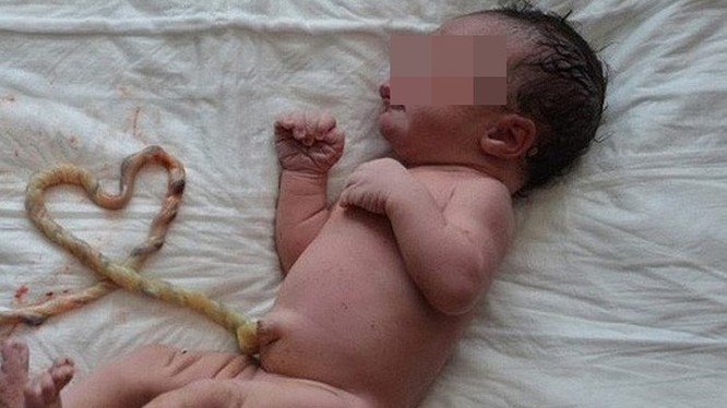 Một em bé bị tử vong nghi do mẹ sinh thuận tự nhiên. Ảnh minh họa