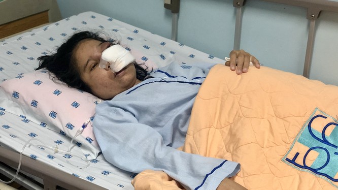 Thai phụ 29 tuần tuổi mắc bệnh hiếm gặp, nguy kịch đến tính mạng và thai nhi. Ảnh: BVCC
