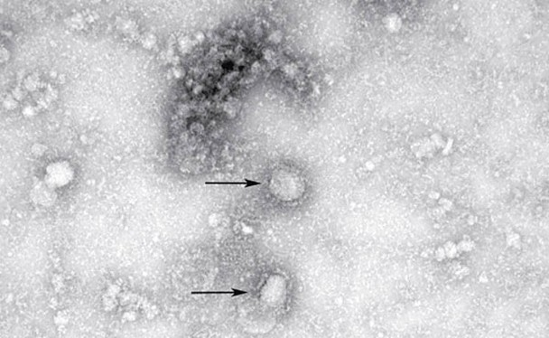 Hình ảnh virus corona chủng mới dưới ống kính hiển vi (Ảnh: Đông Phương)