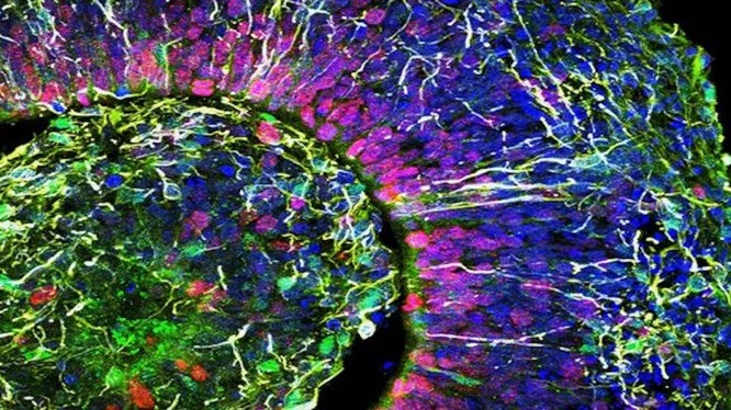 Hình ảnh lát cắt cơ quan tế bào não người (ảnh Đại học California San Diego)
