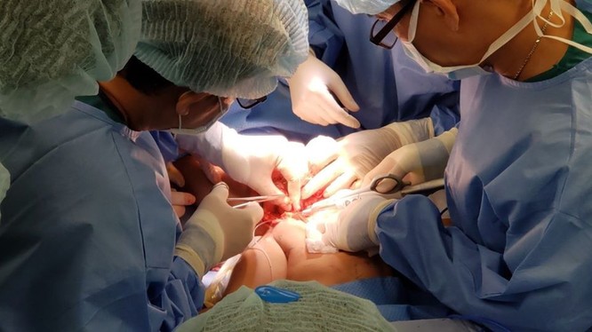 Gần 100 bác sĩ tham gia ca đại phẫu tách rời hai bé Trúc Nhi - Diệu Nhi (Ảnh: BVCC)