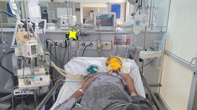 Bệnh nhân Đỗ Văn Ch. (46 tuổi, ở Tĩnh Gia, Thanh Hóa) nhập viện vào BV Bạch Mai trong tình trạng đã ngừng tim, hiện vẫn hôn mê sâu (Ảnh: BVCC) 