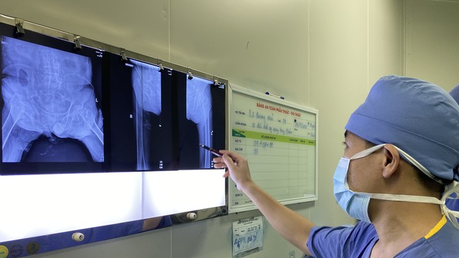 Các bác sĩ xem phim chụp của bệnh nhân. Ảnh: Bệnh viện Hữu nghị Việt Đức 