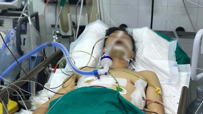Bệnh nhân được điều trị tại Bệnh viện Hữu nghị Việt Đức với nhiều vết thương phức tạp (Ảnh: BVCC) 