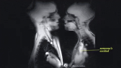12 điều đáng kinh ngạc chỉ có thể nhìn thấy qua máy chụp X-quang ảnh 5