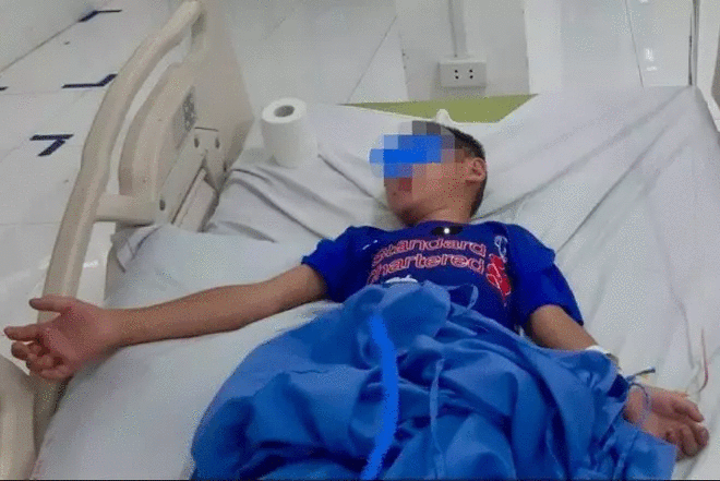 Trẻ bị rắn cắn điều trị tại bệnh viện