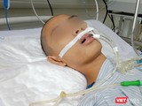 Bệnh nhi hôn mê, thở máy, điều trị đã nhiều ngày tại Khoa Truyền nhiễm, Bệnh viện Nhi Trung ương vì mắc bệnh viêm não Nhật Bản