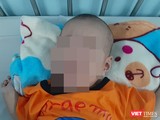 Bé trai 3 tháng tuổi bị tràn dịch phổi, nguy kịch tính mạng