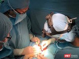 Bác sĩ BV Nhi đồng 1 phẫu thuật tách cặp em bé song sinh dính liền gan