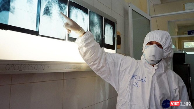 Bác sĩ Trần Thanh Linh đọc kết quả X quang phổi của bệnh nhân COVID-19 (Ảnh: BVCR) 