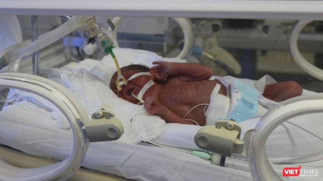 Em bé Bình An đang được điều trị tích cực tại Bệnh viện Phụ sản Trung ương sáng 24/5.