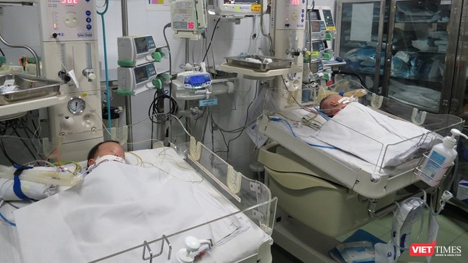 Hai bé song sinh dính liền gan đã được Bệnh viện Nhi đồng 1 phẫu thuật tách rời thành công. Ảnh: Anh Thư