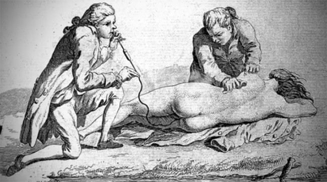 8 phương pháp điều trị y học kỳ lạ chỉ tồn tại trong thời cổ đại ảnh 8
