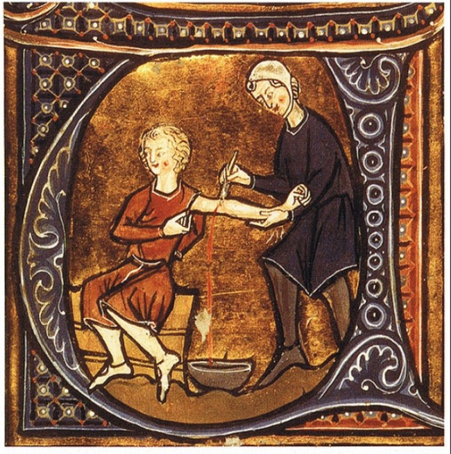 8 phương pháp điều trị y học kỳ lạ chỉ tồn tại trong thời cổ đại ảnh 5