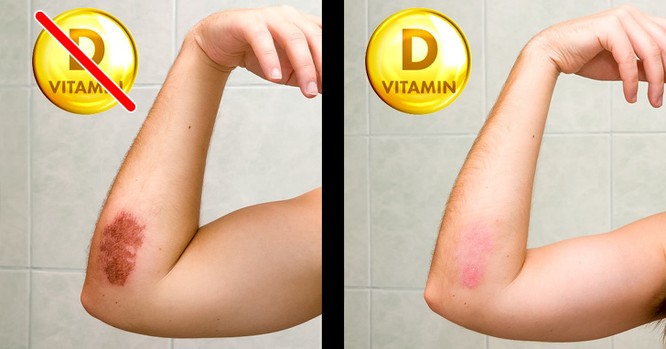 8 dấu hiệu của cơ thể nhắc nhở bạn cần bổ sung ngay vitamin D ảnh 6