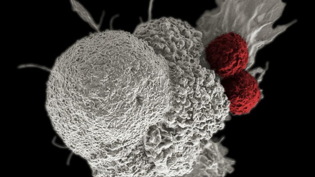 Đột phá: Mỹ thông qua trị liệu gen chữa ung thư máu ảnh 1