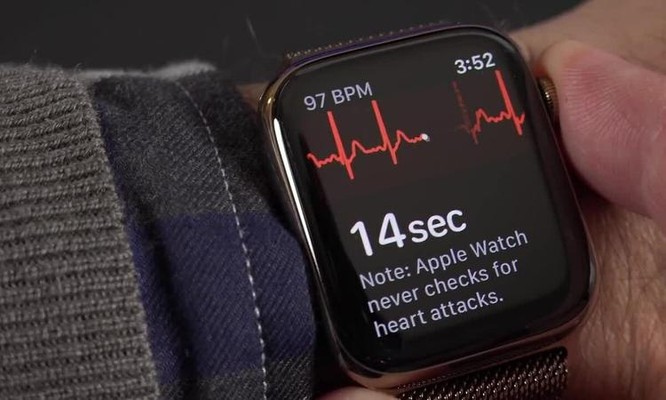 Apple Watch tại Việt Nam sẽ đo được điện tâm đồ ảnh 1