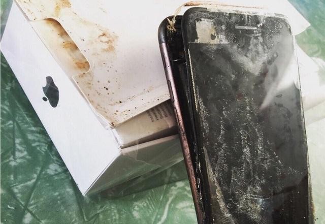 Apple bị kiện vì pin iPhone phát nổ khiến người dùng bị thương ảnh 1