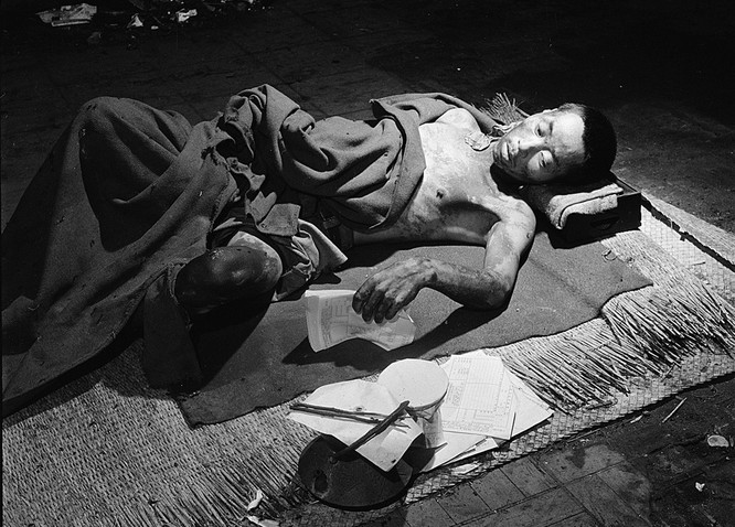 Chùm ảnh độc thảm họa hạt nhân Hirosima 70 năm trước ảnh 27