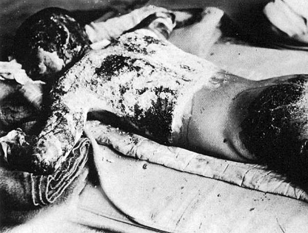 Chùm ảnh độc thảm họa hạt nhân Hirosima 70 năm trước ảnh 39