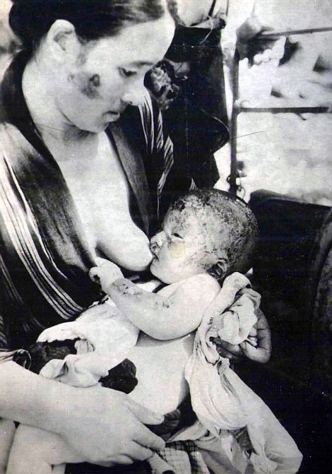 Chùm ảnh độc thảm họa hạt nhân Hirosima 70 năm trước ảnh 47