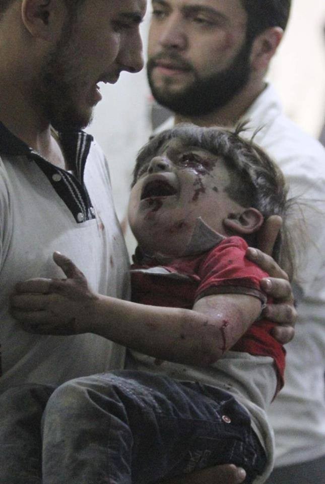 Chùm ảnh thảm họa nhân đạo trẻ em ở địa ngục Syria ảnh 4