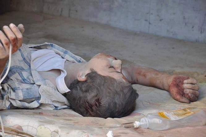 Chùm ảnh thảm họa nhân đạo trẻ em ở địa ngục Syria ảnh 5